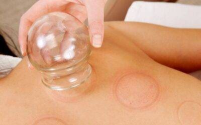 How Cupping Therapy Can Benefit You